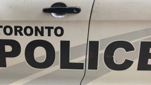 Road construction worker injured in hit-and-run on the DVP: police