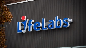 Maximum payout for LifeLabs class action drops from $150 estimate to $7.86