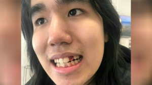 Toronto man who fatally stabbed, decapitated mother in 2022 found guilty of 2nd-degree murder