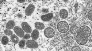Toronto seeing 'spike' in mpox cases: officials