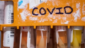 B.C. residents can still get COVID shots until arrival of updated vaccines: province