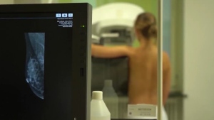 Quebec Breast Cancer Foundation marks 30 years, highlights ongoing fight