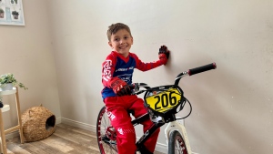 Young boy with cerebral palsy riding BMX bike a year after surgery at Montreal Children's Hospital