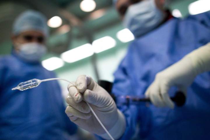 MS could start up to 15 years earlier than thought, new UBC research suggests