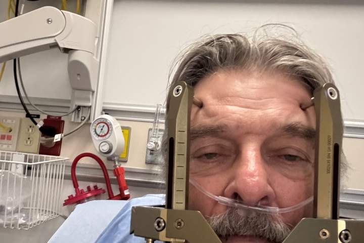 Edmonton clinical trial offers hope to people suffering ‘most severe pains known to mankind’